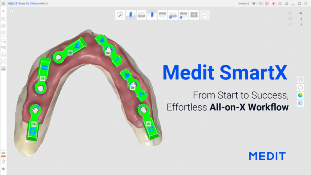 Medit SmartX All-on-X Workflow