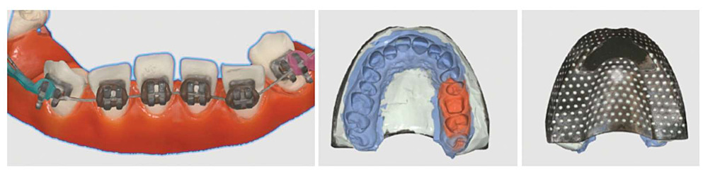 Scanner intraoral Medit i900