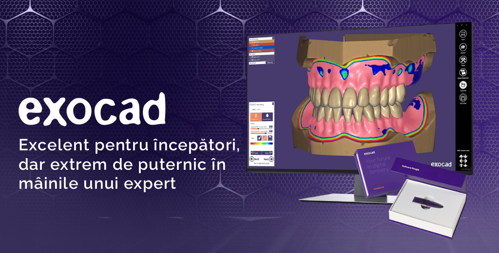 exocad - flexibil, rapid, cu funcții complete