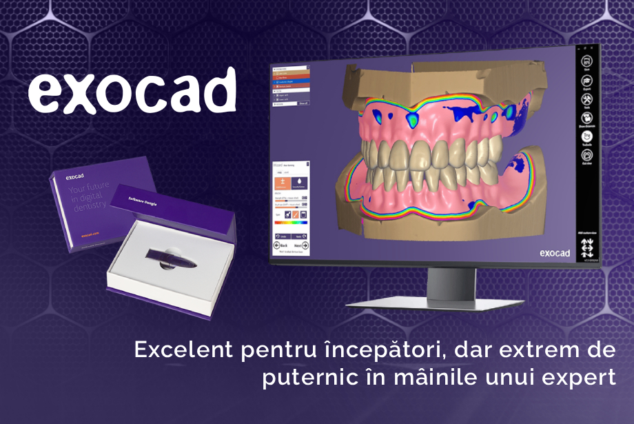 exocad - flexibil, rapid, cu funcții complete
