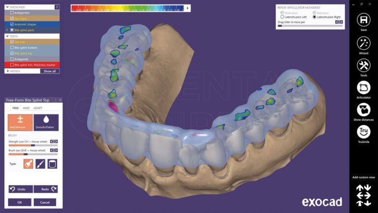 tratament articular creuzet