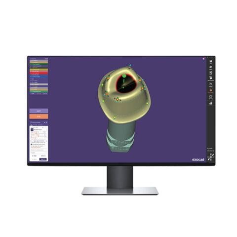 Exocad Chemnitz 3.3 - Software CAD pentru stomatologie și laboratoare dentare