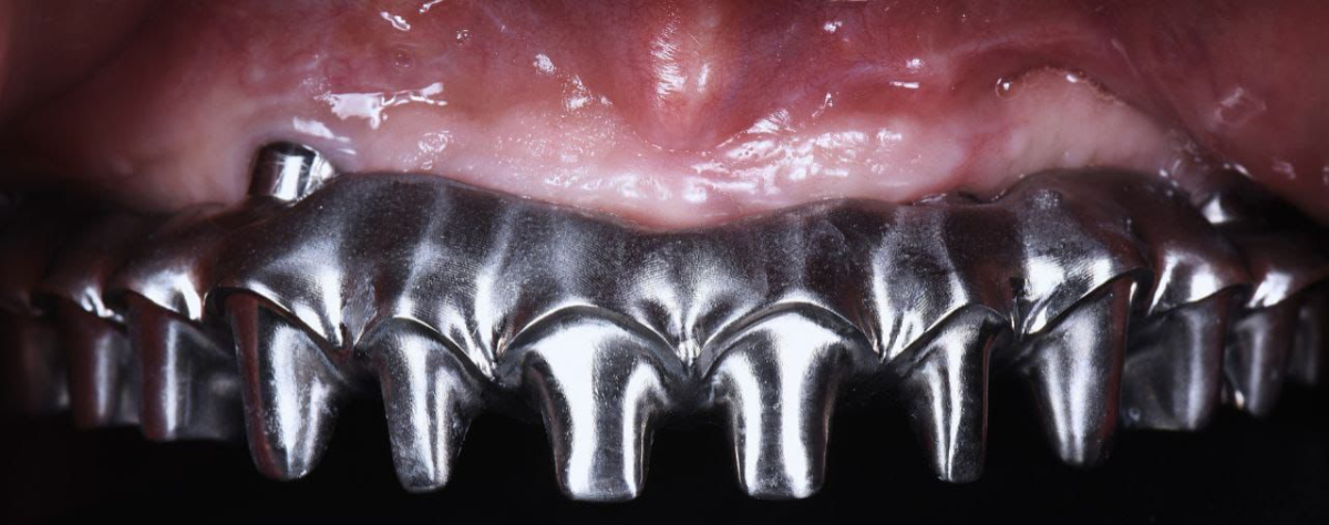 Dotare Clinică Medicală Dentară Dr. Teo cu mașină de frezare de ultimă generație 7