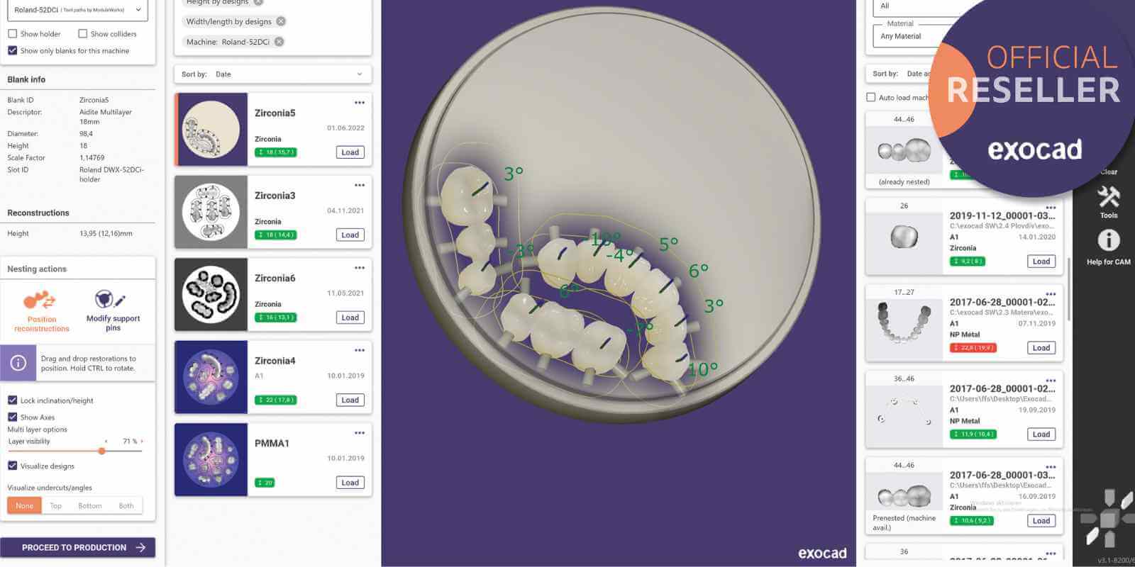 Software CAD Exocad