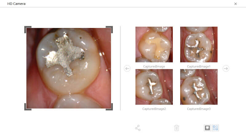 Scaner intraoral Medit i500 - Camera video HD intraorala pentru stomatologie